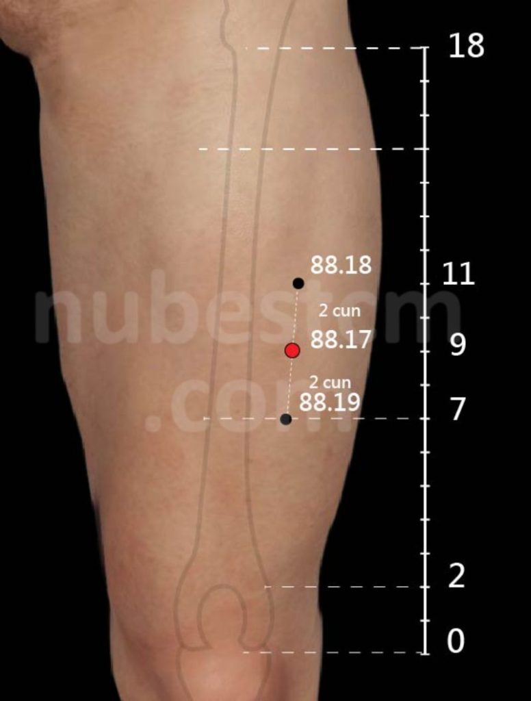 Tung’s Accupuncture: 88.17 Si Ma Zhong – Nubes