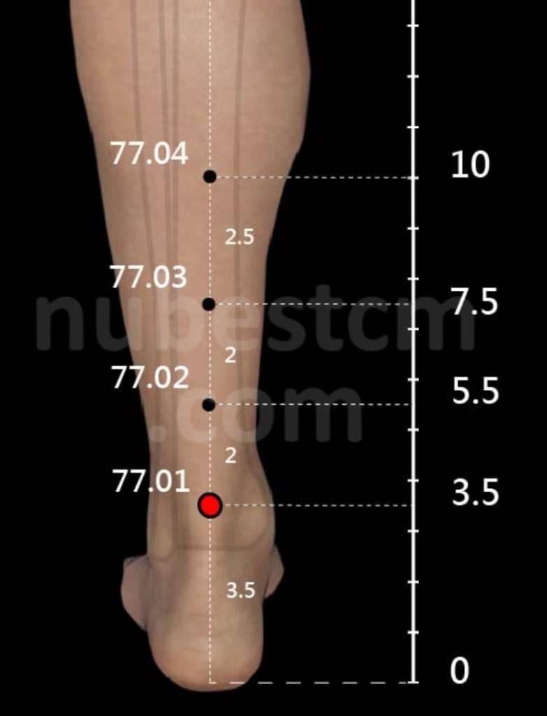 Tung’s Accupuncture: 77.01 Zheng Jin – Nubes